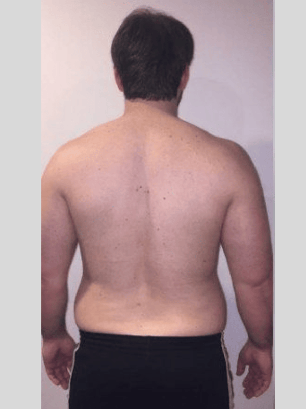 Before transformation 6