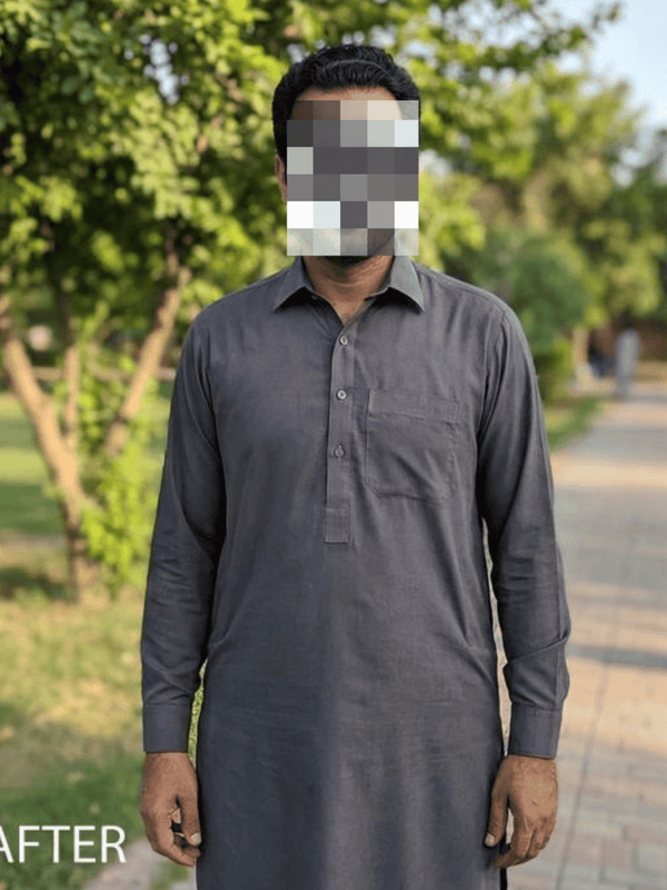 After transformation 3