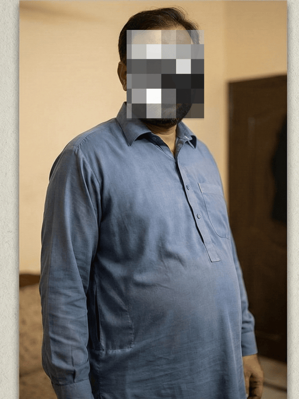 Before transformation 4